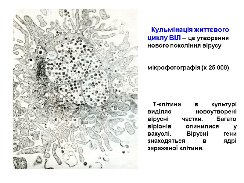 Т-клітина в культурі виділяє новоутворені вірусні частки. Багато віріонів опинилися у вакуолі. Вірусні гени